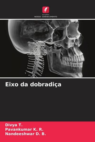 Produktbild: Eixo da dobradi&ccedil;a