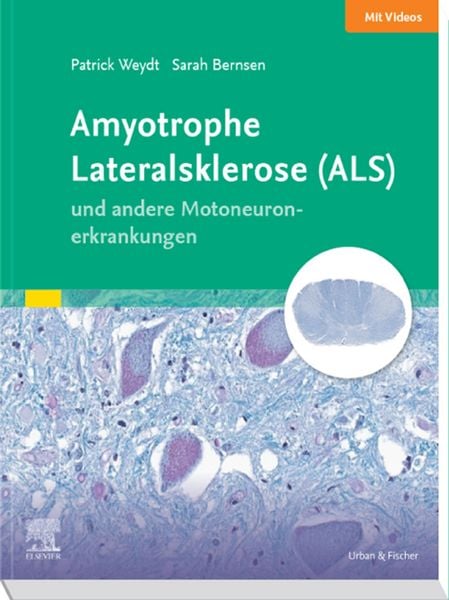 Produktbild: Amyotrophe Lateralsklerose (ALS) und andere Motoneuronerkrankungen