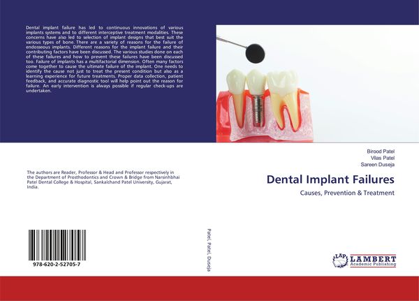 Produktbild: Dental Implant Failures