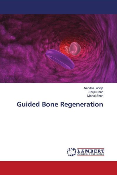 Produktbild: Guided Bone Regeneration