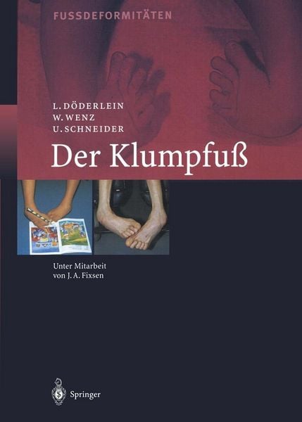 Produktbild: Der Klumpfuss