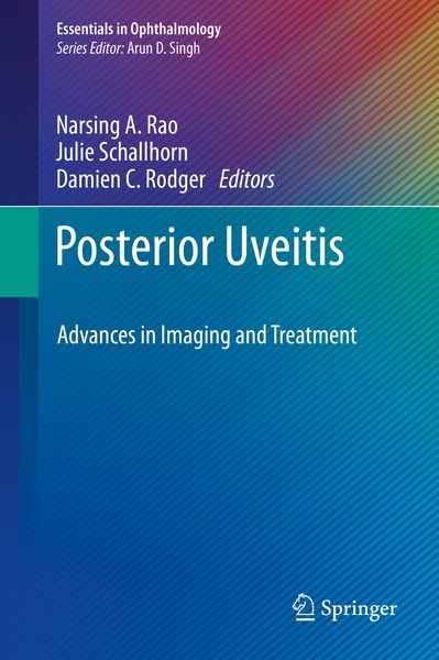 Produktbild: Posterior Uveitis