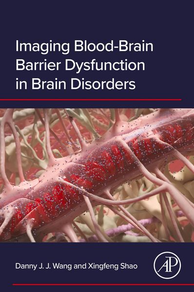 Produktbild: Imaging Blood-Brain Barrier Dysfunction in Brain Disorders