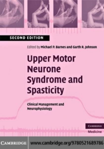 Produktbild: Upper Motor Neurone Syndrome and Spasticity