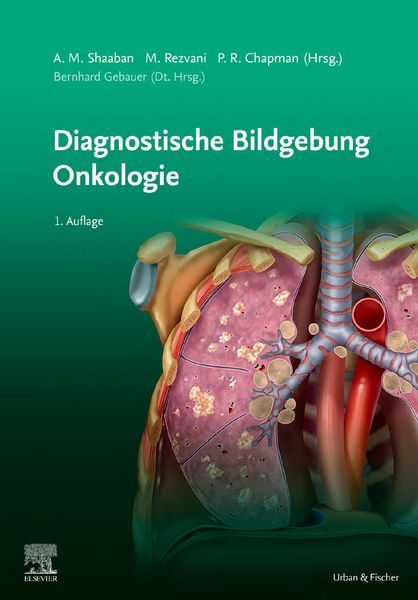 Produktbild: Diagnostische Bildgebung Onkologie