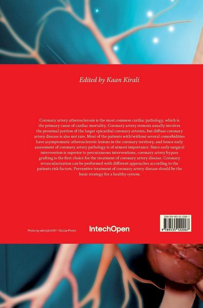 Produktbild: Coronary Artery Disease