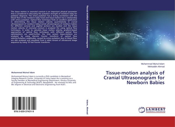 Produktbild: Tissue-motion analysis of Cranial Ultrasonogram for Newborn Babies