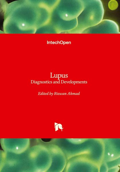 Produktbild: Lupus - Diagnostics and Developments