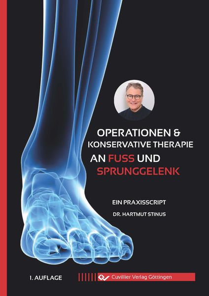 Operationen & konservative Therapie an Fuß und Sprunggelenk, Paperback von Hartmut Stinus, Cuvillier Verlag, 9783736974524