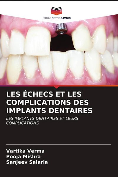 Produktbild: Les &Eacute;checs Et Les Complications des Implants Dentaires