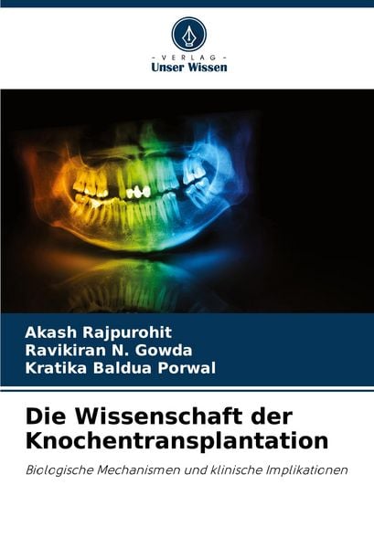 Produktbild: Die Wissenschaft der Knochentransplantation