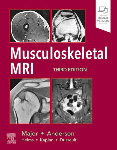 Produktbild: Musculoskeletal MRI E-Book