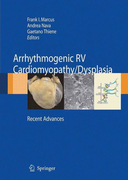 Produktbild: Arrhythmogenic RV Cardiomyopathy/Dysplasia