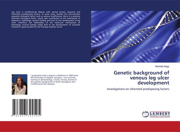 Produktbild: Genetic background of venous leg ulcer development