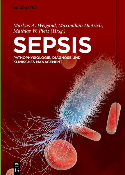 Sepsis, Gebundene Ausgabe von , De Gruyter, 9783110673364