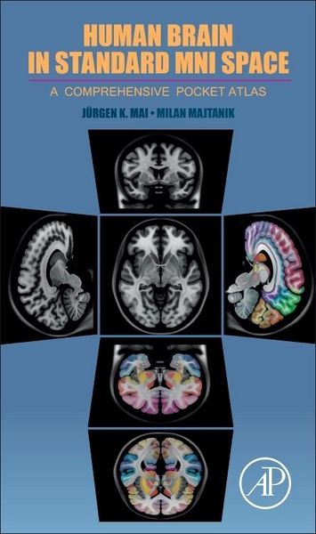 Produktbild: Human Brain in Standard Mni Space