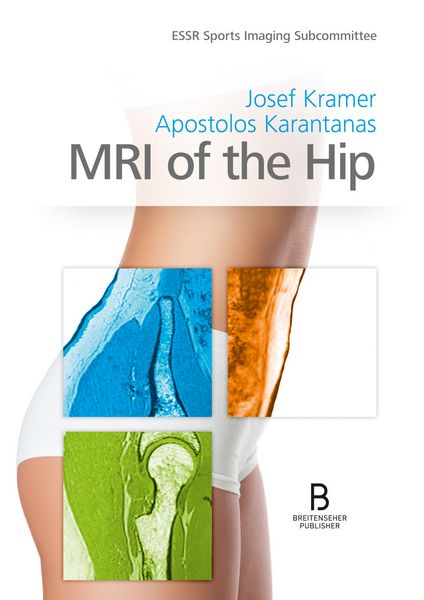 Produktbild: MRI of the Hip