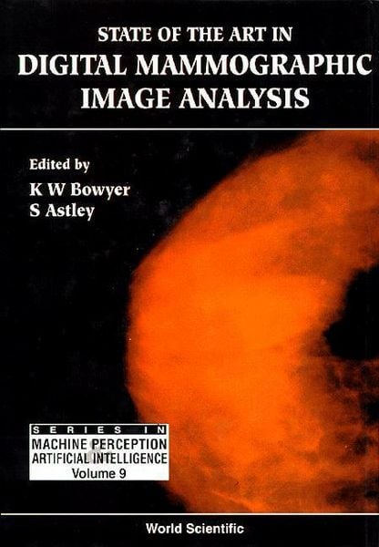 Produktbild: State of the Art in Digital Mammographic Image Analysis