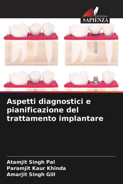 Produktbild: Aspetti diagnostici e pianificazione del trattamento implantare