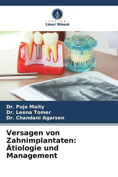 Produktbild: Versagen von Zahnimplantaten: &Auml;tiologie und Management