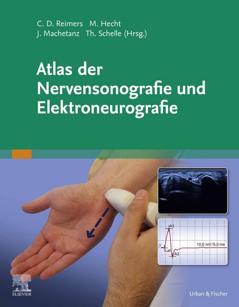 Produktbild: Atlas der Nervensonografie und Elektroneurografie