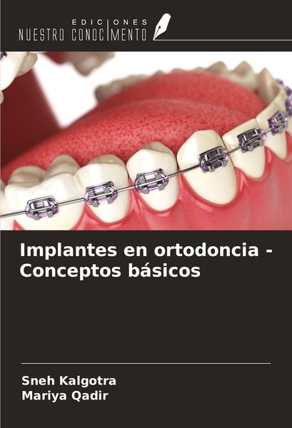 Produktbild: Implantes en ortodoncia - Conceptos b&aacute;sicos