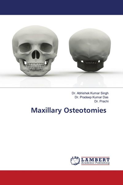 Produktbild: Maxillary Osteotomies