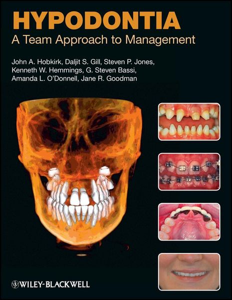 Produktbild: Hypodontia