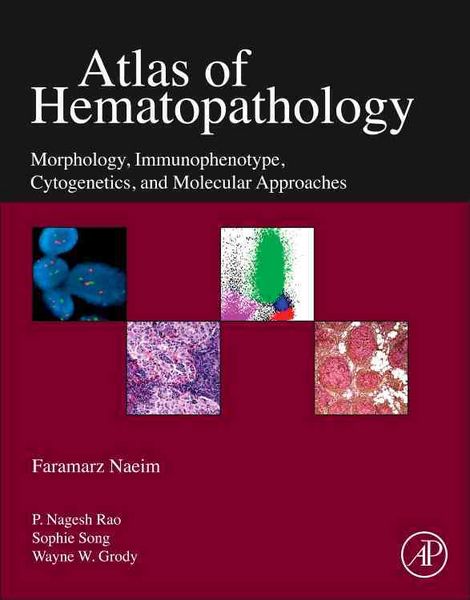 Produktbild: Naeim, F: Atlas of Hematopathology