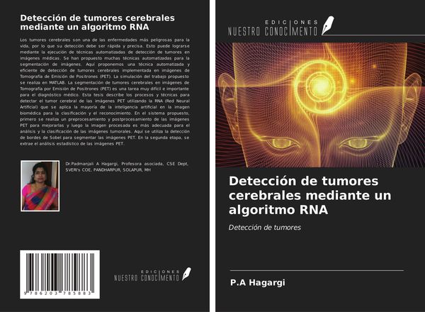 Produktbild: Detecci&oacute;n de tumores cerebrales mediante un algoritmo RNA