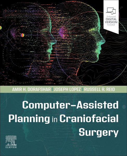 Produktbild: Computer-Assisted Planning in Craniofacial Surgery