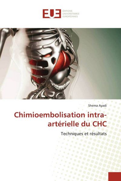 Produktbild: Chimioembolisation intra-art&eacute;rielle du CHC