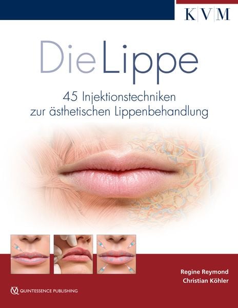Die Lippe, Gebundene Ausgabe von Regine Reymond,Christian Köhler, KVM - Der Medizinverlag, 978-3-86867-402-6