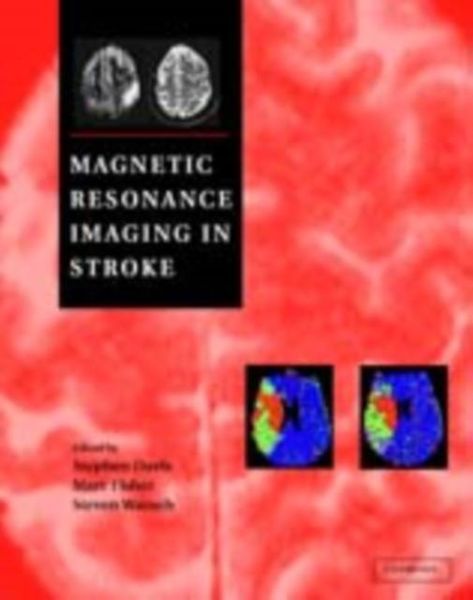 Produktbild: Magnetic Resonance Imaging in Stroke