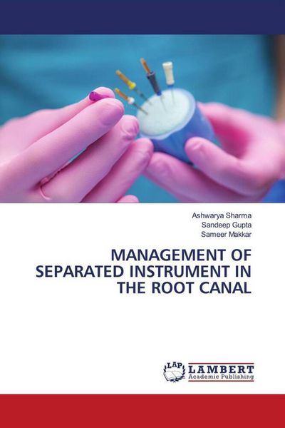 Produktbild: Management Of Separated Instrument in The Root Canal