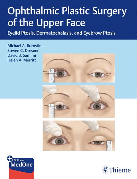 Produktbild: Ophthalmic Plastic Surgery of the Upper Face