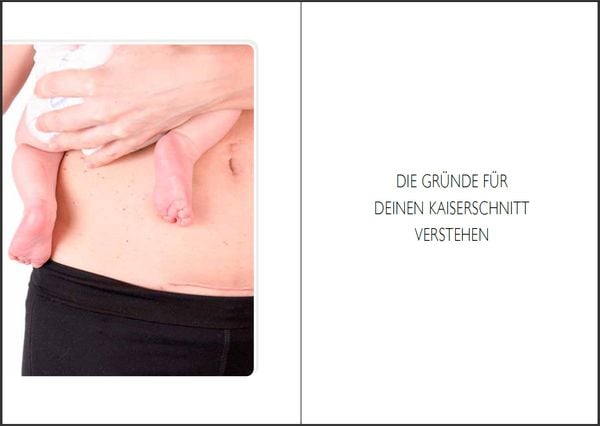 Produktbild: Natürliche Geburt nach Kaiserschnitt: Praxis-Wissen von der Ärztin - Das VBAC-Buch, das deine nächste Schwangerschaft und Geburt vereinfacht