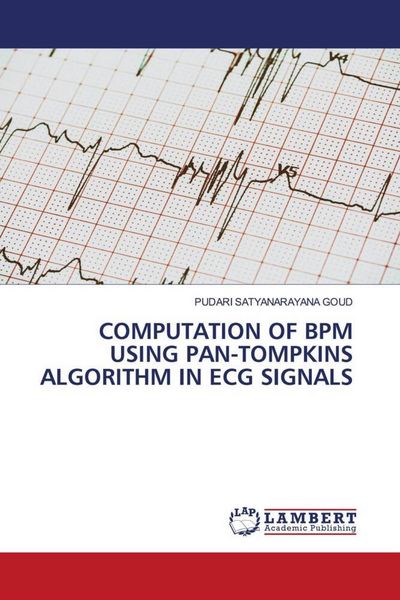 Produktbild: Computation Of Bpm Using Pan-Tompkins Algorithm in Ecg Signals