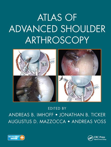 Produktbild: Atlas of Advanced Shoulder Arthroscopy