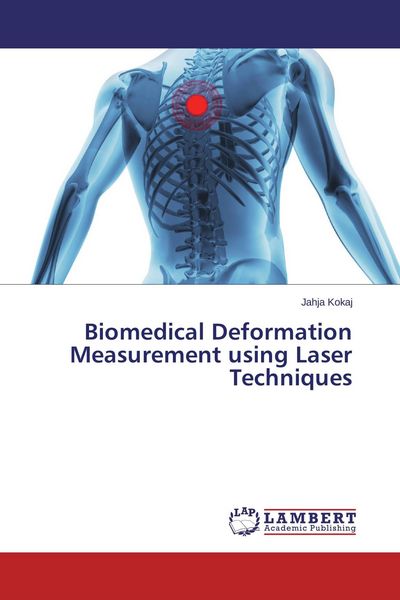 Produktbild: Biomedical Deformation Measurement using Laser Techniques