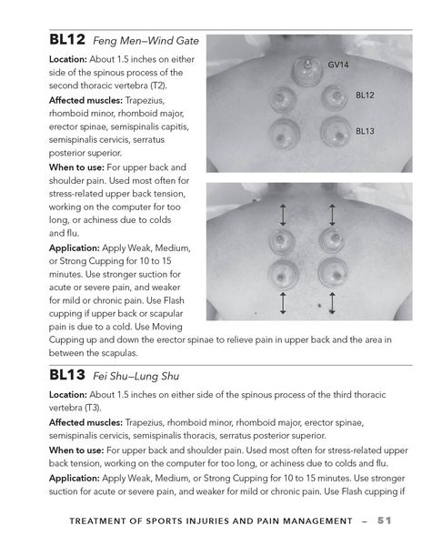 Produktbild: Cupping Therapy for Muscles and Joints