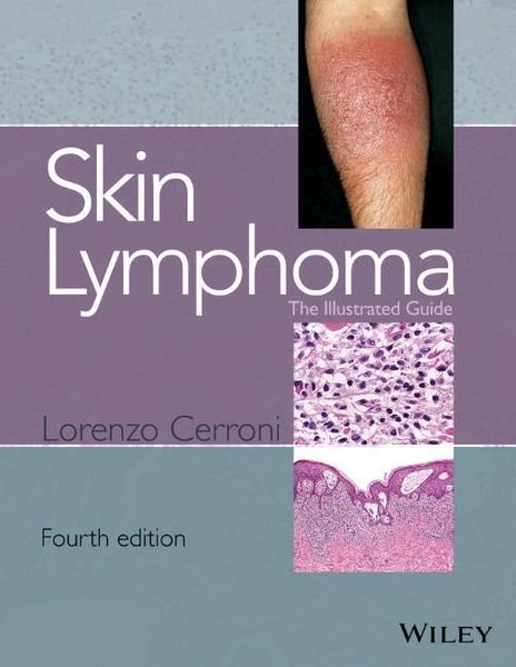 Produktbild: Skin Lymphoma