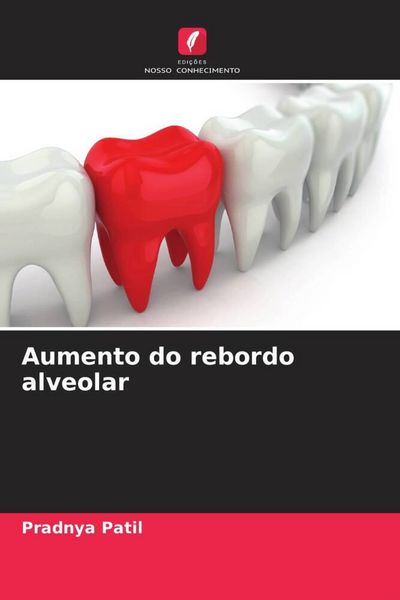 Produktbild: Aumento do rebordo alveolar