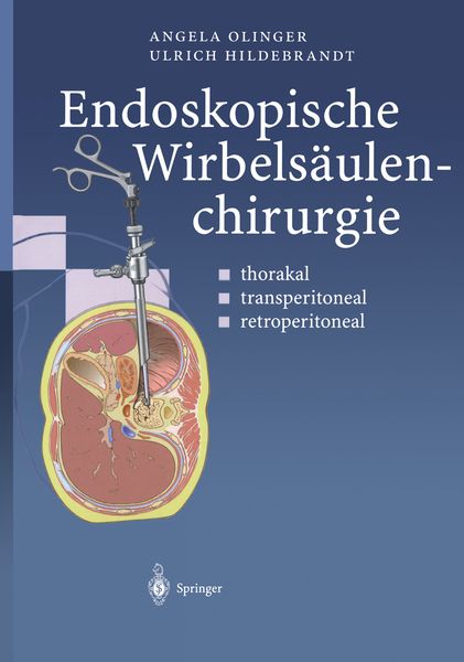 Produktbild: Endoskopische Wirbels&auml;ulenchirurgie