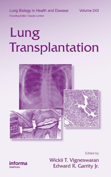 Produktbild: Lung Transplantation