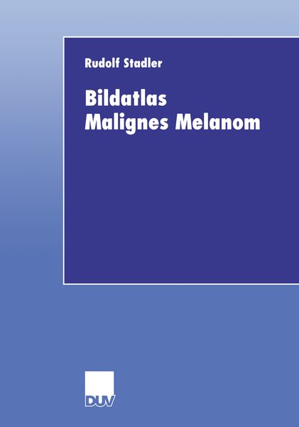 Produktbild: Bildatlas Malignes Melanom
