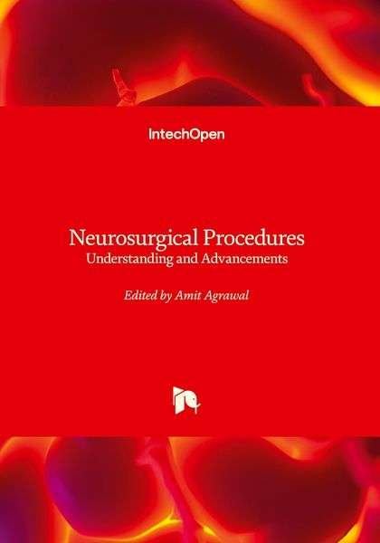 Produktbild: Neurosurgical Procedures - Understanding and Advancements