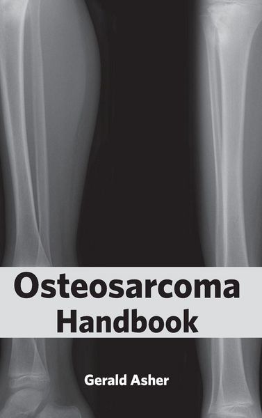 Produktbild: Osteosarcoma Handbook