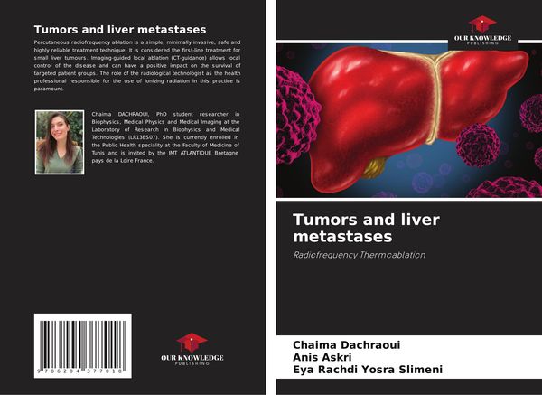 Produktbild: Tumors and liver metastases