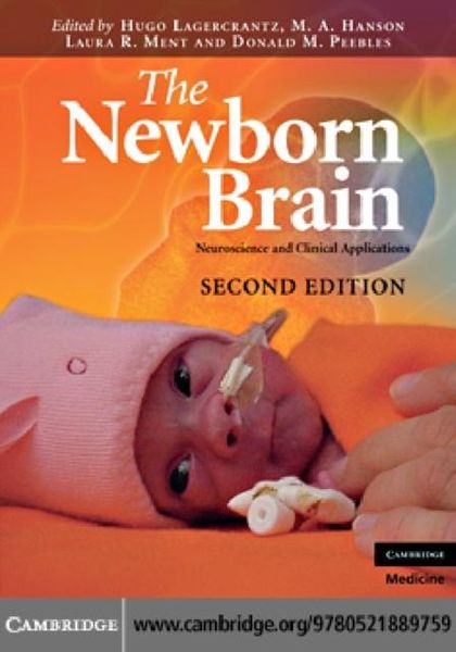 Produktbild: Newborn Brain